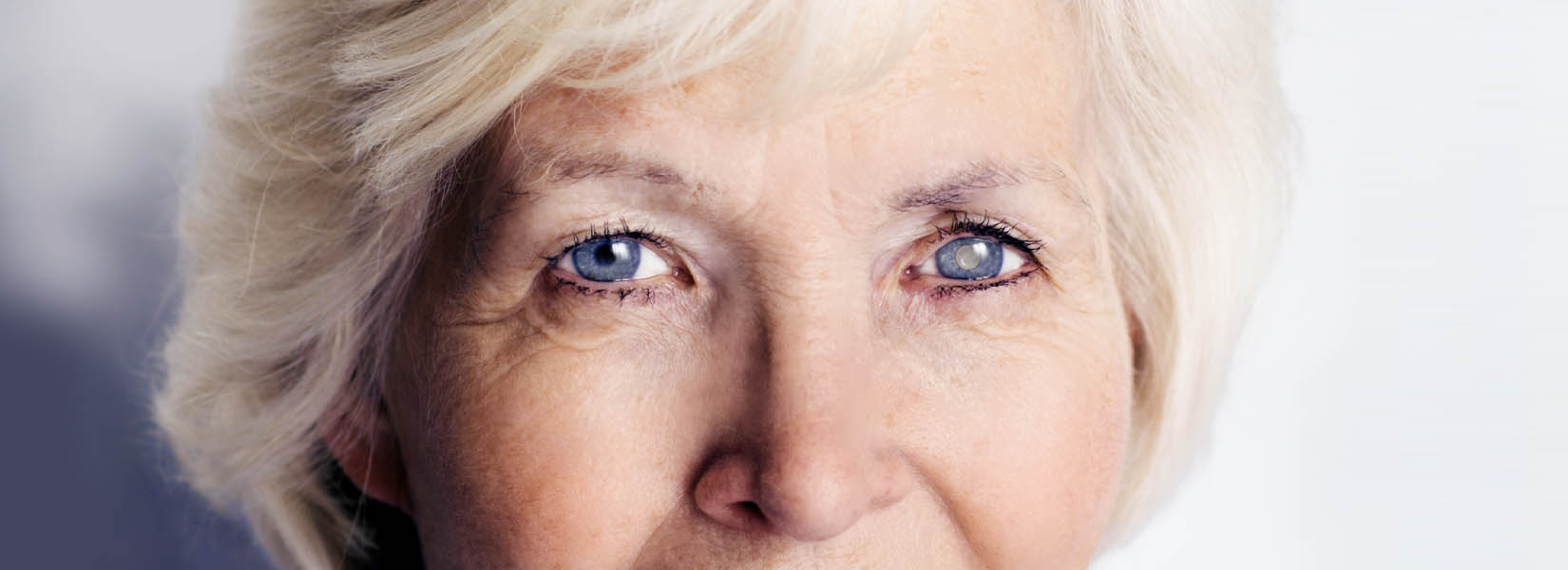 Cataract Surgery in Tempe